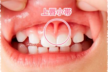 仕上げみがき_1