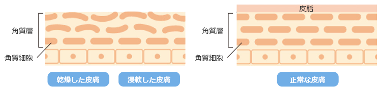 乾燥した皮膚、浸軟した皮膚と正常な皮膚