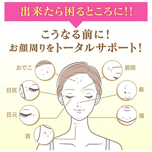 小林製薬　薬用ケシミン　浸透化粧水　しっとりもちもち肌　つめかえ用　１４０ｍＬ　１個5