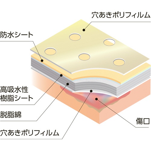 スズラン　ケアエイド　穴あきポリパッド　Ｌ　１個（７枚）2
