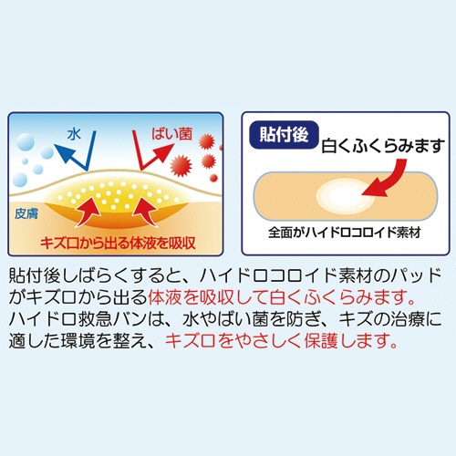 日進医療器　リーダー　ハイドロ救急バン　Ｍサイズ　徳用　１箱（１００枚）2