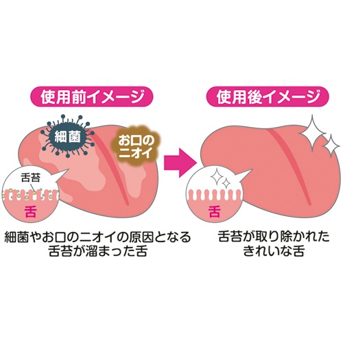 松本金型　新感覚舌ブラシ　したつつみ　ピンク　１本5