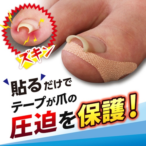 サイプラス　巻き爪テープ　クイこまなーい　１パック（１０枚）3