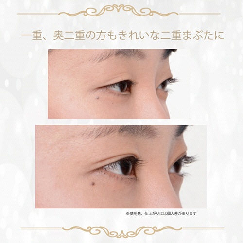 アチーブ　ルドゥーブル　４ｍｌ　１本8