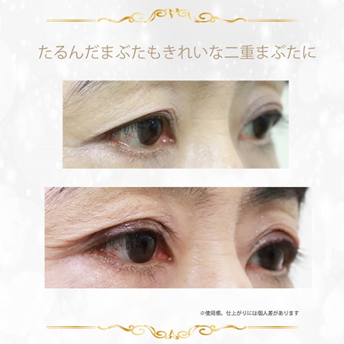 アチーブ　大人のルドゥーブル　２ｍｌ　１本9