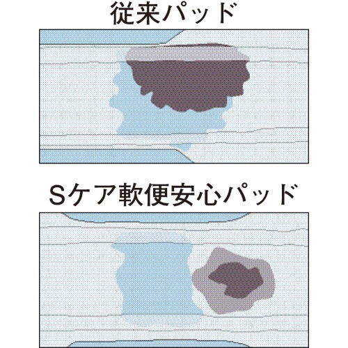 大王製紙　アテント　Ｓケア　軟便安心パッド　１セット（８０枚：２０枚×４パック）3